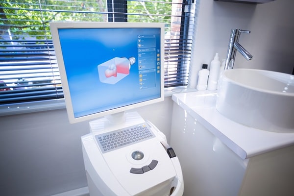 itero-scanner-mercato-dental-centre