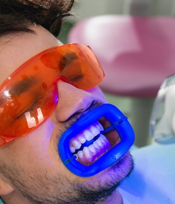 teeth-whitening-mercato-dental-centre-east-vancouver