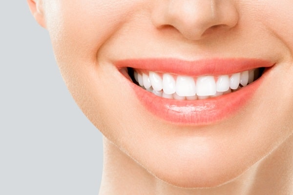 teeth-whitening-mercato-dental-centre