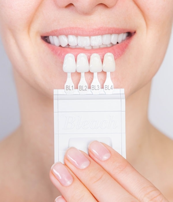 veneers-mercato-dental-centre-in-east-vancouver